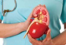 این چهار نوشیدنی را صبح‌ها مصرف نکنید تا کلیه‌تان سالم بماند