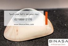 پروتز چشم خود را کجا تعویض کنیم؟