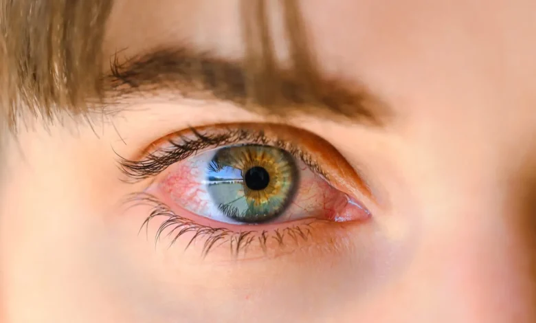 پلک‌زدن در واقع بینایی ما را تقویت می‌کند