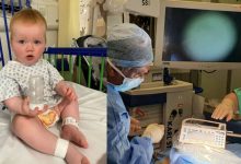 برای اولین بار، کودک 18 ماهه با روش ژن‌درمانی جدید، شنوایی خود را به دست آورد