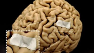 دانشمندان ایمپلنت «ورق زیستی» را تولید کرده‌اند که با پارکینسون مقابله می‌کند!