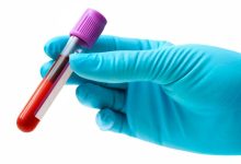 این آزمایش خون جدید میتواند بازگشت سرطان سینه را از سه سال زودتر پیشبینی کند