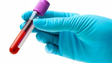 این آزمایش خون جدید می‌تواند بازگشت سرطان سینه را از سه سال زودتر پیش‌بینی کند