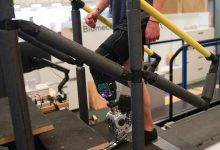 افراد دچار قطع عضو می‌توانند این پای مصنوعی را با مغز خود کنترل کنند [تماشا کنید]