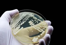 کشف عفونت قارچی جدید در چین؛ آیا گرمایش جهانی مقصر است؟