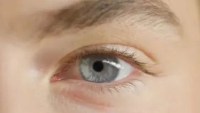 برآمدگی‌های زردرنگ اطراف چشم می‌تواند با مشکل قلبی مرتبط باشد
