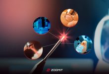 لیزر، معجزه‌ نور؛ از جراحی تا صنعت و کاوش‌های فضایی