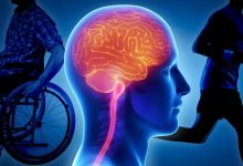 نشانههایی از ابتلا به اماس که پیش از بروز علائم قابلشناسایی است