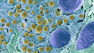 دانشمندان برای اولین بار دیابت نوع اول را معکوس کردند