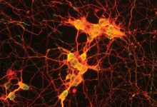 دانشمندان میگویند به غیر از مغز سلولهای دیگر بدن نیز حافظه دارند