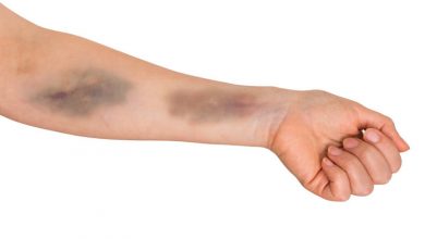 پنج نشانه کمبود مواد مغذی در بدن