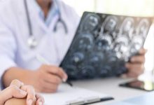 چرا شتاب پیری مغز در افراد مختلف متفاوت است؟