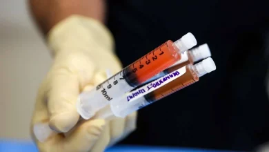 از پارکینسون تا دیابت: پیشرفتهای چشمگیر در درمان بیماریها با سلولهای بنیادی