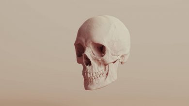 برخی از موارد اسکیزوفرنی ممکن است ناشی از ناهنجاریهای جمجمه باشد