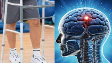 دو فرد مبتلا به آسیب نخاعی پس از کاشت الکترود در مغزشان، مسافت کوتاهی راه رفتند