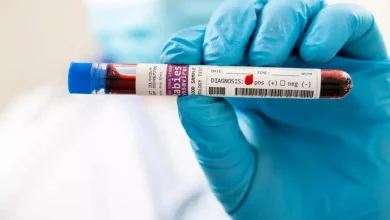 ناپدید شدن 323 ویال حاوی ویروس آزمایشگاهی کشنده در استرالیا