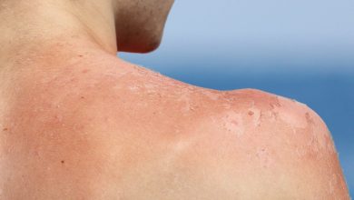 ویروسهای پوست ناجی احتمالی ما در برابر نور خورشید هستند