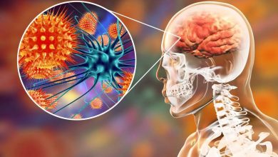 ویروسی شایع میتواند عامل نوعی آلزایمر باشد